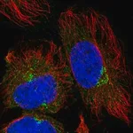 Merck Anti-TRIM44 antibody produced in rabbit