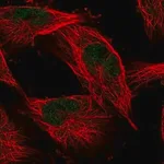 Merck Anti-COMMD1 antibody produced in rabbit