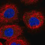 Merck Anti-RDH10 antibody produced in rabbit