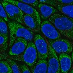 Merck Anti-RSAD2 antibody produced in rabbit