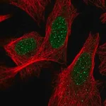 Merck Anti-ACD antibody produced in rabbit