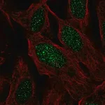 Merck Anti-C19orf44 antibody produced in rabbit