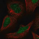 Merck Anti-MLH3 antibody produced in rabbit