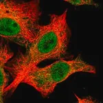 Merck Anti-SLX4 antibody produced in rabbit