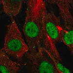 Merck Anti-SHOX antibody produced in rabbit