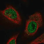 Merck Anti-FEM1C antibody produced in rabbit