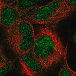 Merck Anti-IMP3 antibody produced in rabbit