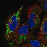 Merck Anti-PGM2L1 antibody produced in rabbit