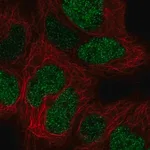 Merck Anti-CTR9 antibody produced in rabbit