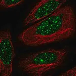Merck Anti-THRB antibody produced in rabbit