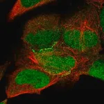 Merck Anti-KIAA0895 antibody produced in rabbit
