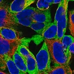 Merck Anti-EPN1 antibody produced in rabbit