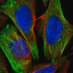 Merck Anti-CSGALNACT1 antibody produced in rabbit