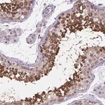 Merck Anti-TTC12 antibody produced in rabbit