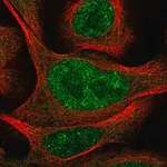 Merck Anti-POLR3D antibody produced in rabbit