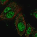 Merck Anti-NFX1 antibody produced in rabbit