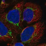 Merck Anti-AARS2 antibody produced in rabbit