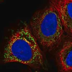 Merck Anti-PAPSS2 antibody produced in rabbit