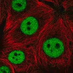 Merck Anti-ZNF335 antibody produced in rabbit