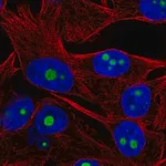 Merck Anti-ACTR10 antibody produced in rabbit