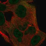 Merck Anti-ITGB1BP1 antibody produced in rabbit