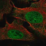 Merck Anti-SETDB2 antibody produced in rabbit