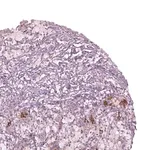 Merck Anti-CHST14 antibody produced in rabbit