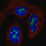 Merck Anti-NAT10 antibody produced in rabbit