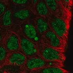 Merck Anti-KLF8 antibody produced in rabbit