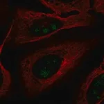 Merck Anti-FOXL2NB antibody produced in rabbit