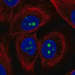 Merck Anti-KCNJ14 antibody produced in rabbit