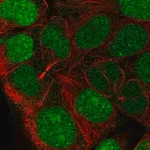 Merck Anti-CCDC84 antibody produced in rabbit