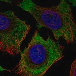 Merck Anti-ENTPD3 antibody produced in rabbit