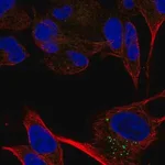 Merck Anti-CACNA2D2 antibody produced in rabbit
