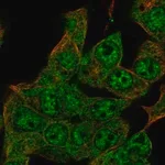 Merck Anti-ZIM2 antibody produced in rabbit