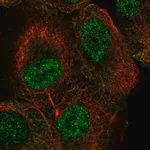 Merck Anti-TUT1 antibody produced in rabbit
