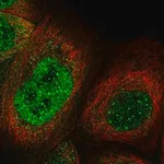 Merck Anti-KNL1 antibody produced in rabbit