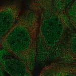 Merck Anti-PUM2 antibody produced in rabbit
