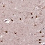 Merck Anti-PSMC2 antibody produced in rabbit