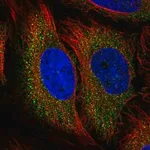 Merck Anti-TSC2 antibody produced in rabbit