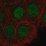Merck Anti-SIRT6 antibody produced in rabbit