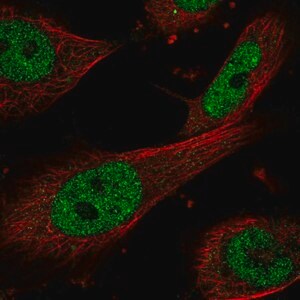 Merck Anti-ERCC1 antibody produced in rabbit