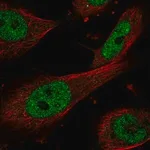 Merck Anti-ERCC1 antibody produced in rabbit