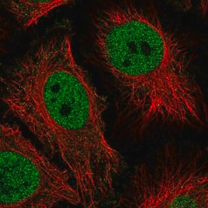 Merck Anti-HMG20B antibody produced in rabbit