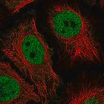 Merck Anti-HMG20B antibody produced in rabbit