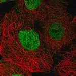 Merck Anti-SPEN antibody produced in rabbit