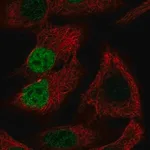 Merck Anti-MORC4 antibody produced in rabbit