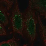 Merck Anti-WDR88 antibody produced in rabbit