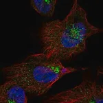 Merck Anti-KIAA1147 antibody produced in rabbit