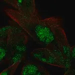 Merck Anti-VWA5A antibody produced in rabbit